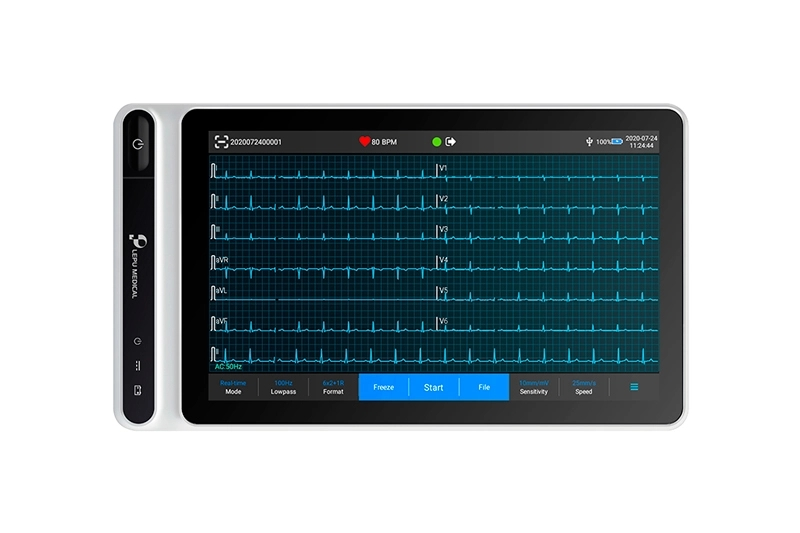 Applicazioni cliniche di monitoraggio Ecg portatile per la diagnosi delle malattie cardiaca